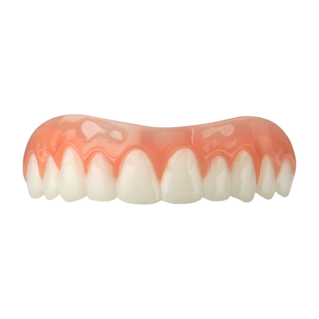 American Smile Veneer (Upper Only)