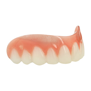 American Smile Veneer (Upper Only)