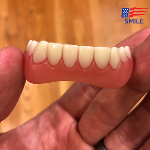 American Smile Veneer (Upper & Lower)