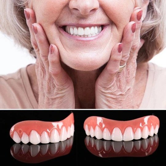 American Smile Veneer (Upper & Lower)